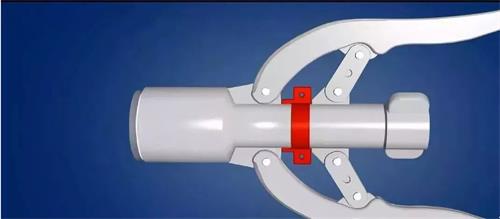 包皮切割吻合器注冊審查指導(dǎo)原則(2021年第102號)(圖1) 包皮切割吻合器注冊審查指導(dǎo)原則(2021年第102號)(圖1)