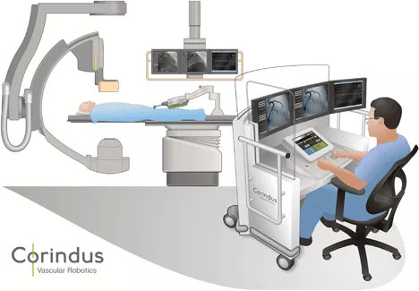 血管腔內介入手術機器人首例臨床試驗案例及未來發(fā)展方向(圖2)