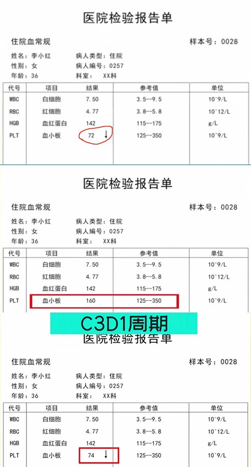 AE與研究藥物關系記錄不一致，如何處理？