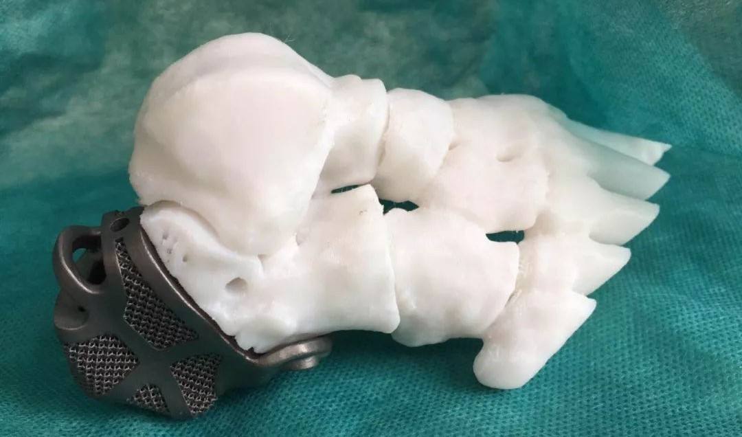 定制式個(gè)性化骨植入物等效性模型注冊(cè)技術(shù)審查指導(dǎo)原則(2020年第48號(hào))(圖1) 定制式個(gè)性化骨植入物等效性模型注冊(cè)技術(shù)審查指導(dǎo)原則(2020年第48號(hào))(圖1)